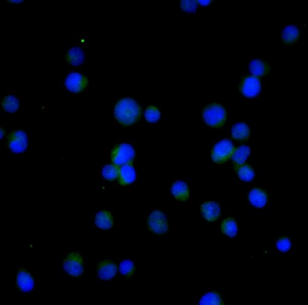 Bcl 2 Antibody 经典一抗