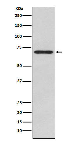 Glypican 3 Antibody_经典一抗-