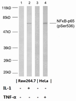 Phospho-NF- KappaB P65 (Ser536) Antibody_经典一抗-