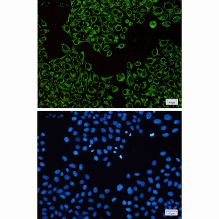 Atpb Rabbit Mab