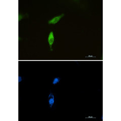 Sqstm P Rabbit Mab