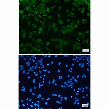 CDKN2A Rabbit mAb 经典一抗